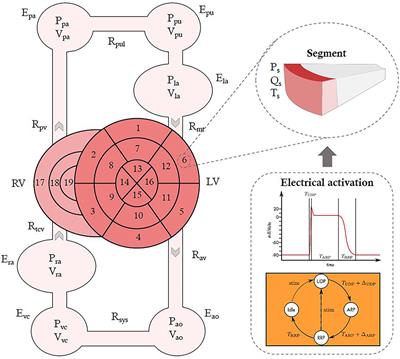 Model-based analysis of myocardial strains in left bundle branch block